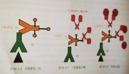 为什么要做免疫组化检查？
